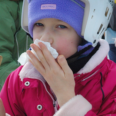 Kleenex does nothing to prevent facial buildup of maple taffy